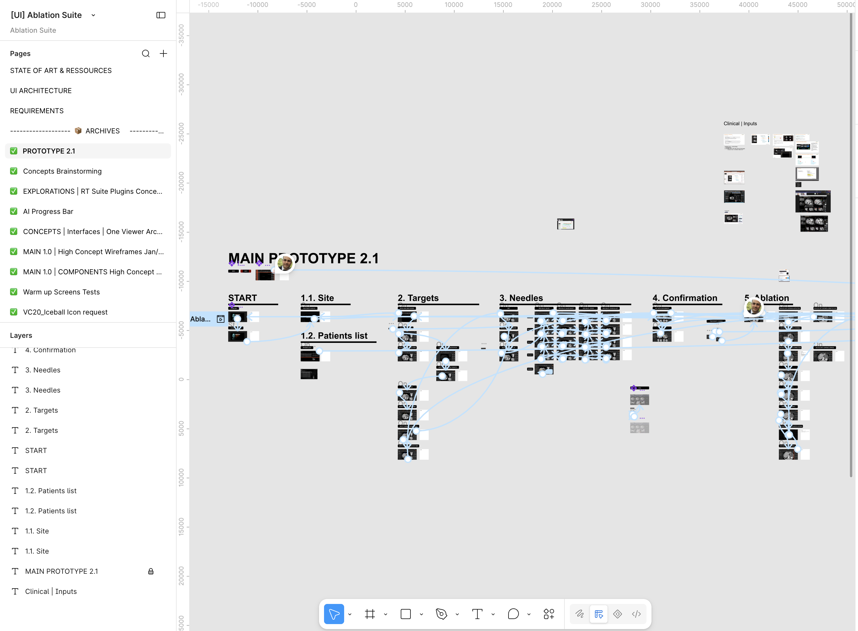 Figma prototype view